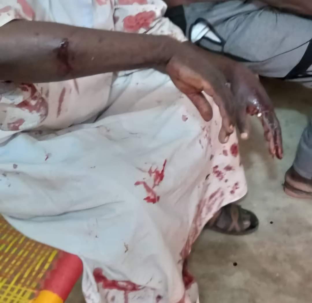 More than 8 people injured by heavy RSF shelling on Abushok IDP Camp in Elfashir, North Darfur. KeepEyesOnSudanقصف معسكر أبوشوك للنازحين:غرفة طوارئ معسكر أبوشوك:-سقوط أكثر من 10 قذيفة من قبل قوات الدعم السريع مما ادي الي اصابة اكثر من 8 شخص للآن جراء القصف العشوائي تجاه إنسان معسكر أبوشوك المغلوب في أمره